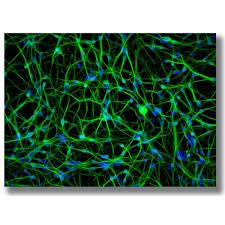 Human Induced Pluripotent (HIP™) Neural cells
