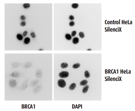 Immunocytochemical staining of stable BRCA1 KD SilenciX cell line