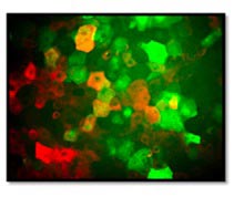 tebu-bio primary cell sourcing Human Primary Sebocytes Zenbio