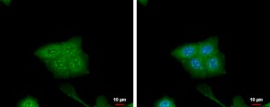 IF with CRABP2 antibody [N1C3] (cat. nr GTX101551). Source: GeneTex and tebu-bio.