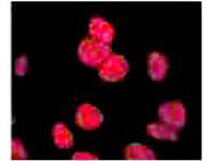 Anti ATM antibody showing overlay of anti-ATM pS1981 staining. Cells were fixed 15 min after 5 Gy (IR+) of irradiation, then labeled with antibody. See Kitagawa et al. for additional details. Source: Rockland immunochemicals.