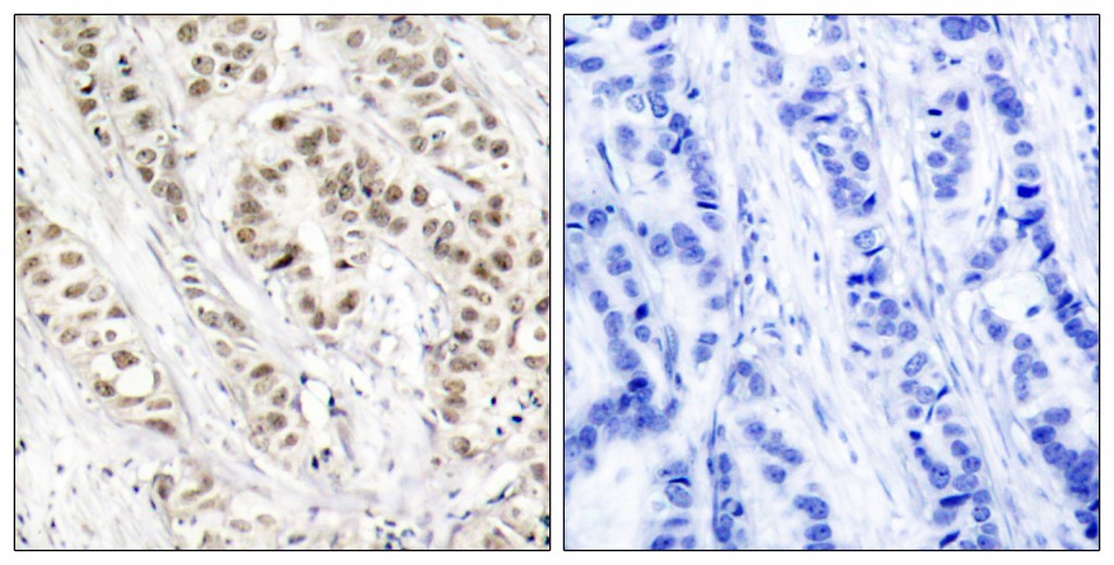 BRCA1 PhosphoSer1524 antibody E011117