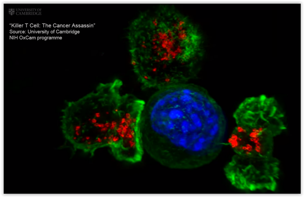 Killer T Cell - The Cancer Assasin May 2015, University of Cambridge, NIH OxCam programme - Killer T-Cell Credit: Gillian Griffiths/Jonny Settle