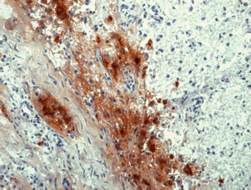 Immunohistochemistry staining of human pituitary gland (frozen sections) with anti-human beta Endorphin (GTX21419)