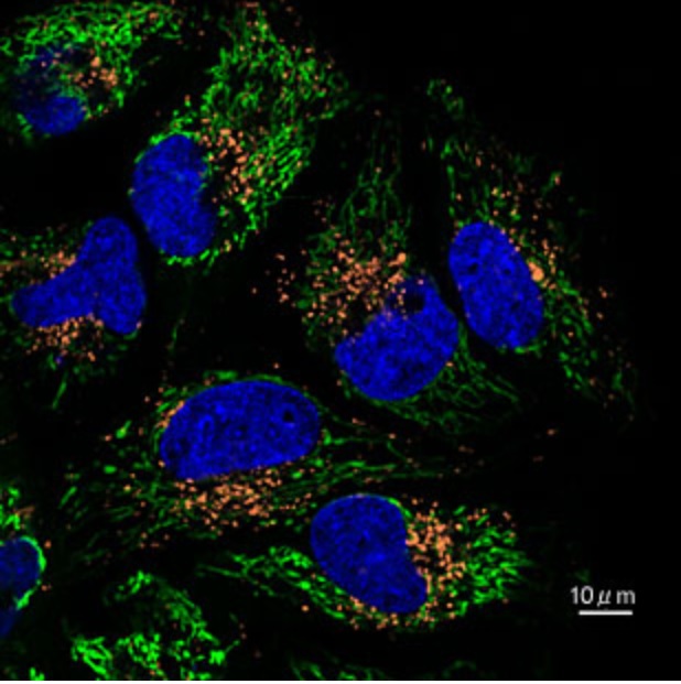 Multicolor imaging using HeLa cells expressing Mitochondria-GFP: Lysosomes were stained with AcidiFluor™ ORANGE (ref. GC301) and nucleuses were stained blue with Hoechst33342.