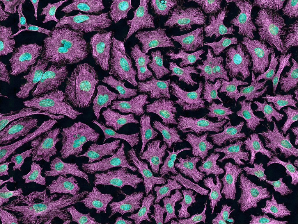 Multiphoton fluorescence image of HeLa cells with cytoskeletal microtubules (magenta) and DNA (cyan). Nikon RTS2000MP custom laser scanning microscope. Image by National Institutes of Health (NIH).
