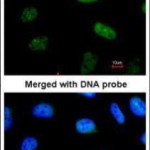 GTX 104616 anti STAT3 tebu-bio genetex
