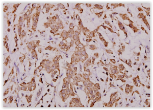 Anti Cytochrome c (H19) pAb in paraffin-embedded human breast carcinoma tissue BS1089 Bioworld Technology tebu-bio