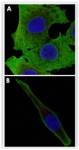 Anti SOD1 Confocal IF of PANC-1 (A) and SK-BR-3 (B) clone 6F5 MAB10394 Abnova tebu-bio (green)