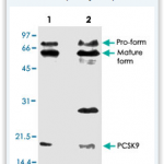 Western blot analysis of PCSK9 polyclonal antibody (Cat # PAB17045).
