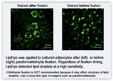 live-or-fixed-adipocytes-staining-with-lipidye-lipid-droplet-green-cat-nr-194fdv-0010-source-funakoshi-tebu-bio