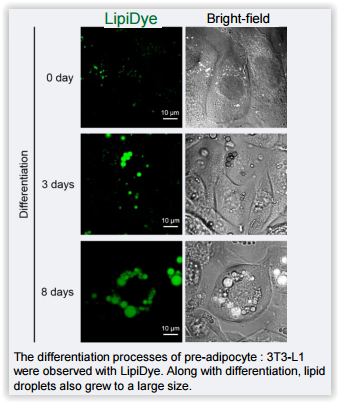 pre-adipocytes-staining-with-lipidye-lipid-droplet-green-cat-nr-194fdv-0010-all-over-their-differenciation-to-adipocytes-source-funakoshi-tebu-bio