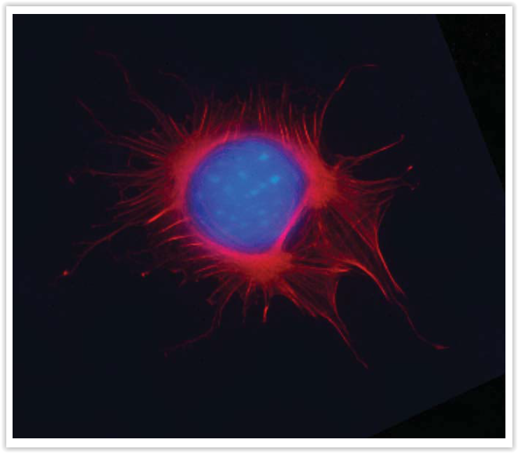 Cystoskeleton #4 - F-actin visualized with Act-Stain™ 670 (PHDN1) in pre-mitotic HeLa cells. Cytoskeleton Inc.
