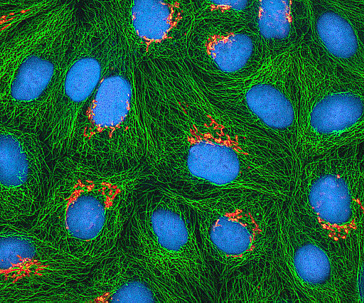 HeLa cells in fluorescent microscopy