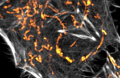PKmito ORANGE (also known as PKMO) is a unique fluorescent probe for live cell mitochondria imaging.