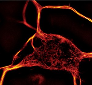 SiR Tubulin tebu-bio's fluorescent dye