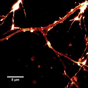 Live Cell Imaging: User results with SiR-Actin & SiR-Tubulin: STED image of cultured rat hippocampal neurons stained with SiR-Actin.