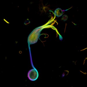 Live Cell Imaging: User results with SiR-Actin & SiR-Tubulin: 3-D projection of a single isolated goldfish retinal bipolar cell stained with SiR-Tubulin.