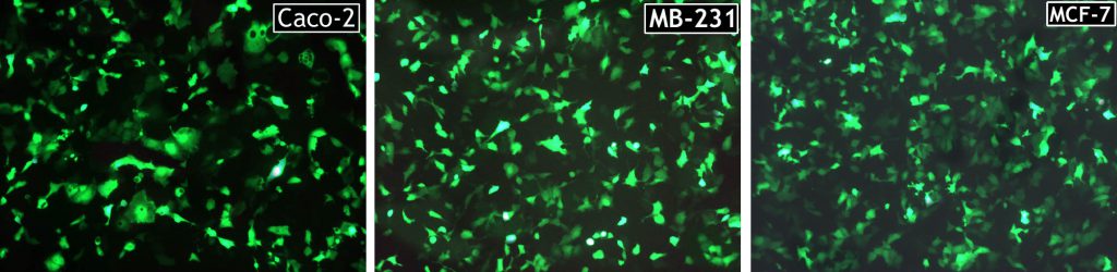 eGFP expression revealing transfection efficiency