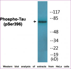 Western blot analysis of HeLa extracts with tha anti-Tau antibody used in the CytoGLOW Tau (Phospho-Ser396) Colorimetric Cell-Based ELISA Kit cat. nr CBP1697. Arbor Assay tebu-bio
