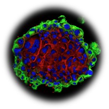 DIVERSA kits