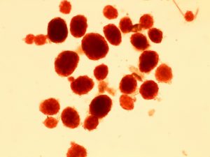 Human Islets for Research (HIR)®